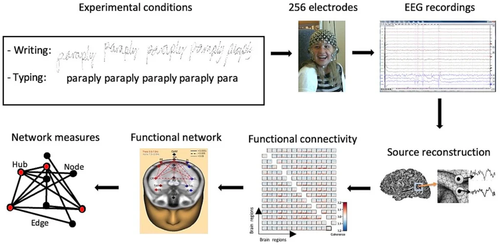 Conectividad cerebral