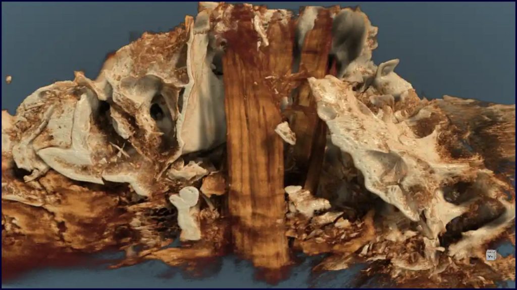 Poste Cerca De La Cremación Más Antigua De Alemania