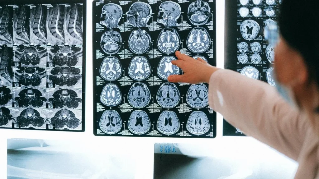 El Envejecimiento Del Cerebro