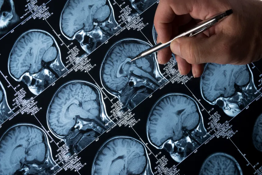 Cómo influye en el cerebro
