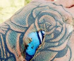 Tratamiento y evolución